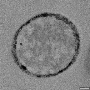 Scanning electron microscopy of an MRSA (S. aureus) bacterium after Azyro magnetic field exposure, showing morphological disruption of the cell wall.