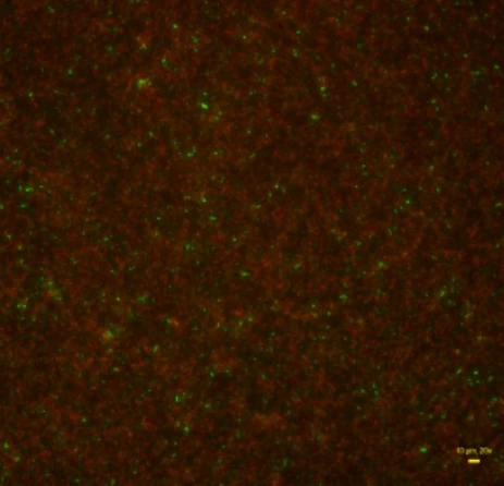 Fluorescence microscopy of a P. aeruginosa biofilm after the Azyro MF treatment combined with PHMB.