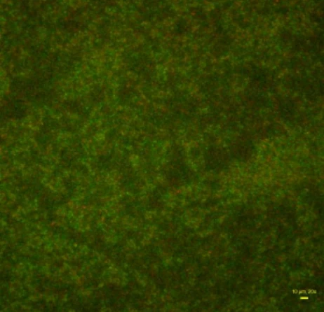 Fluorescence microscopy of a P. aeruginosa biofilm after the Azyro MF treatment.