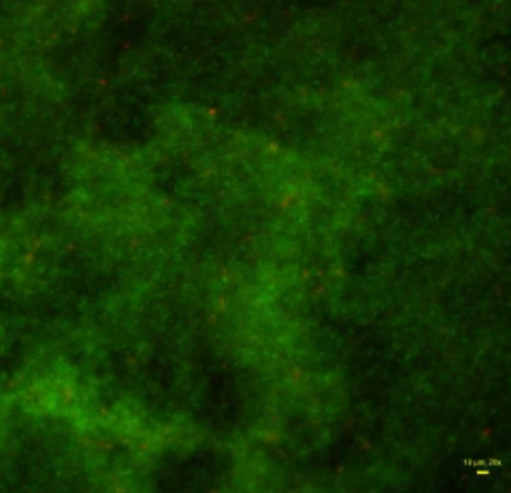 Fluorescence microscopy of an untreated P. aeruginosa biofilm.
