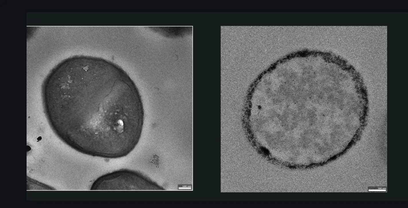 Scanning electron microscopy panels showing the S. aureus cell wall intact and visibly disrupted after Azyro magnetic-field exposure.