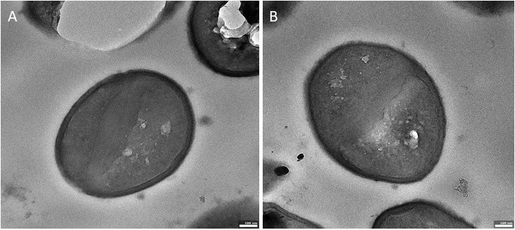 Scanning electron microscopy panels A and B: the S. aureus cell wall before and after exposure to the Azyro magnetic field.