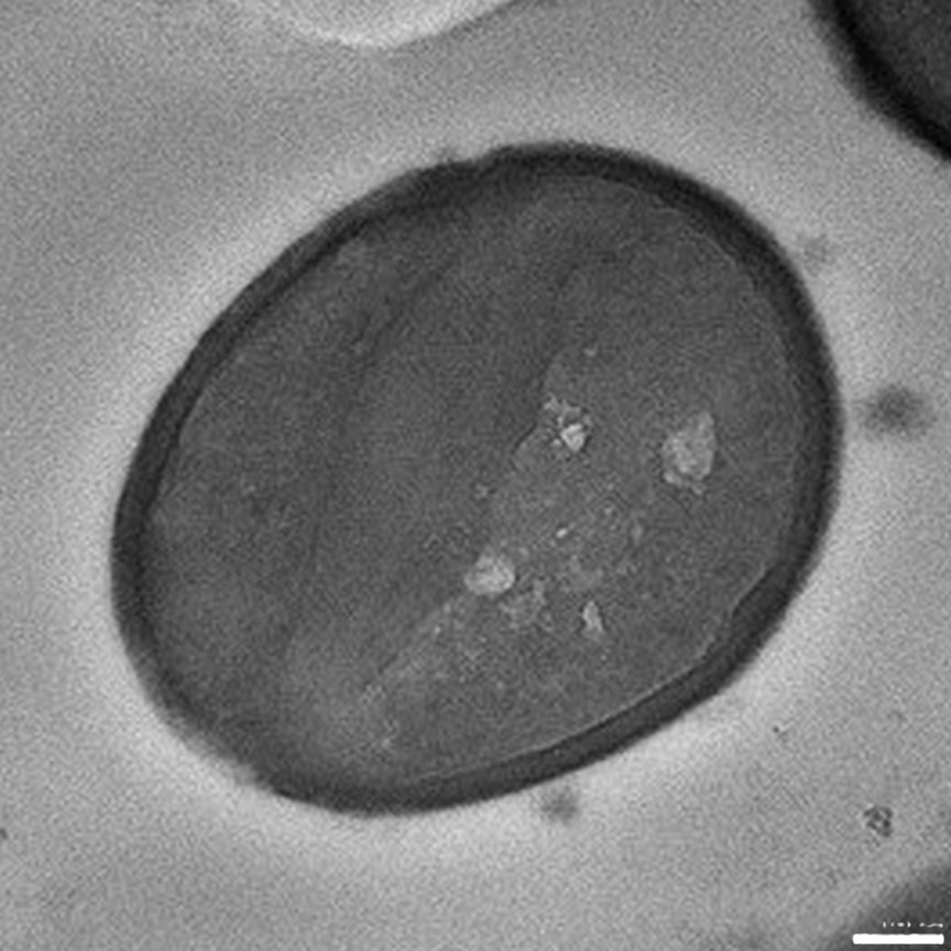 Transmission electron microscopy of an untreated methicillin-resistant S. aureus (MRSA) cell.